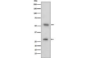 Western blot analysis of CD97 expression in human tonsil cell lysate.
