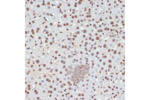 Immunohistochemistry of paraffin-embedded mouse liver using Phospho-p53-S33 antibody (ABIN6135330, ABIN6136276, ABIN6136277 and ABIN6225656) at dilution of 1:100 (40x lens). (p53 anticorps  (pSer33))