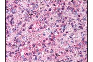 Image no. 1 for anti-Transient Receptor Potential Cation Channel, Subfamily C, Member 3 (TRPC3) (Trp3) antibody (ABIN303023)