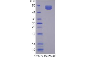 Image no. 1 for Interleukin 20 Receptor alpha (IL20RA) (AA 269-545) protein (His tag,GST tag) (ABIN4990299)