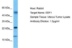 Host: Rabbit Target Name: EDF1 Sample Type: Uterus Tumor lysates Antibody Dilution: 1. (EDF1 anticorps  (N-Term))
