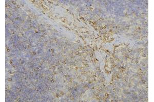 ABIN6277719 at 1/100 staining Human lymph node tissue by IHC-P. (ADH6 anticorps)