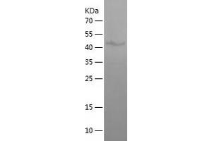 Western Blotting (WB) image for Outer Dense Fiber of Sperm Tails 1 (ODF1) (AA 1-250) protein (His-IF2DI Tag) (ABIN7124283)