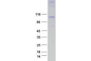Validation with Western Blot
