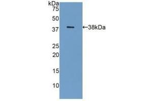 Detection of Recombinant GAL8, Human using Polyclonal Antibody to Galectin 8 (GAL8) (LGALS8 anticorps  (AA 1-317))