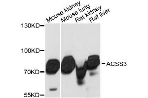 Western blot analysis of extracts of various cell lines, using ACSS3 antibody. (ACSS3 anticorps)
