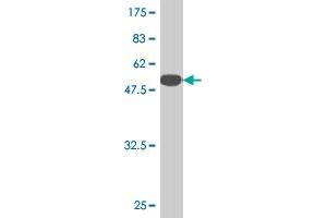 Western Blot detection against Immunogen (51. (TK1 anticorps  (AA 1-234))