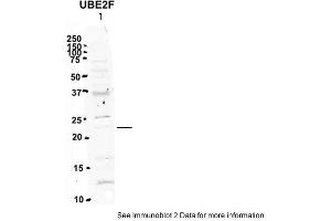 Sample Type: 1. (UBE2F anticorps  (N-Term))