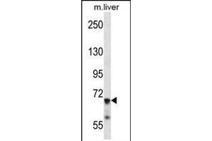 IL1R1 Antibody (C-term) (ABIN657915 and ABIN2846862) western blot analysis in mouse liver tissue lysates (35 μg/lane).