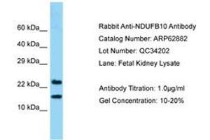 Image no. 1 for anti-NADH Dehydrogenase (Ubiquinone) 1 beta Subcomplex, 10, 22kDa (NDUFB10) (AA 91-140) antibody (ABIN6749956) (NDUFB10 anticorps  (AA 91-140))