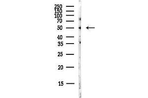 anti-Thioredoxin Interacting Protein (TXNIP) (Internal Region) antibody