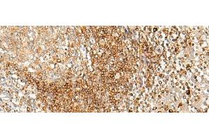 Immunohistochemistry of paraffin-embedded Human tonsil tissue using HLA-DPA1 Polyclonal Antibody at dilution of 1:35(x200) (HLA-DPA1 anticorps)