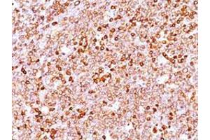 Immunohistochemical staining (Formalin-fixed paraffin-embedded sections) of human tonsil with CD79A recombinant monoclonal antibody, clone IGA/1688R . (Recombinant CD79a anticorps  (AA 208-222))