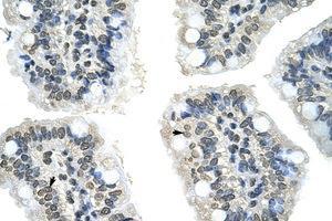 anti-GIPC PDZ Domain Containing Family, Member 2 (GIPC2) (N-Term) antibody