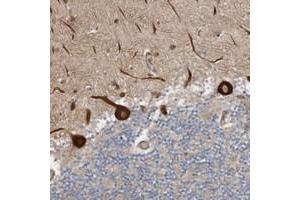 Immunohistochemical staining of human cerebellum with LUZP1 polyclonal antibody  shows strong cytoplasmic positivity in Purkinje cells at 1:50-1:200 dilution. (LUZP1 anticorps)