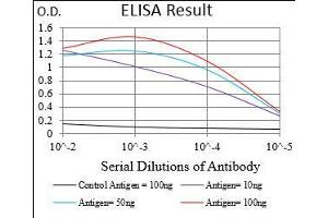 Black line: Control Antigen (100 ng), Purple line: Antigen(10 ng), Blue line: Antigen (50 ng), Red line: Antigen (100 ng),