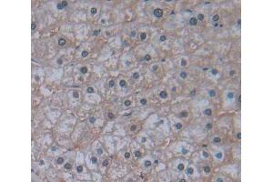 Used in DAB staining on fromalin fixed paraffin- embedded liver tissue