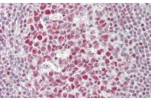 Detection of NCL in Human Tonsil Tissue using Polyclonal Antibody to Nucleolin (NCL)