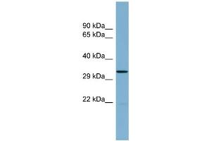 WB Suggested Anti-THG1L Antibody Titration:  0. (THG1L anticorps  (Middle Region))