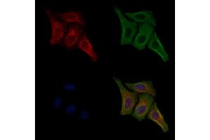 ABIN7093228 and ABIN7097240 staining HepG2 cells(4h of LPS treatment) by IF/ICC. (Insulin Receptor anticorps  (pTyr1355))
