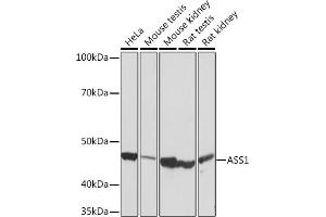 Western blot analysis of extracts of various cell lines, using  Rabbit mAb (ABIN7265669) at 1:1000 dilution. (ASS1 anticorps)
