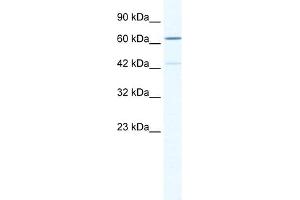 WB Suggested Anti-ZNF419 Antibody Titration:  0. (ZNF419 anticorps  (N-Term))
