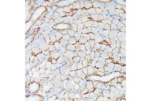 Immunohistochemistry of paraffin-embedded mouse kidney using CD225/IFITM1 antibody (ABIN1680390, ABIN3018715, ABIN3018716 and ABIN6220553) at dilution of 1:100 (40x lens). (IFITM1 anticorps  (C-Term))