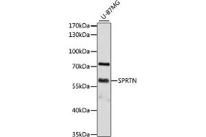 Western blot analysis of extracts of U-87MG cells, using SPRTN antibody (ABIN6131455, ABIN6148388, ABIN6148390 and ABIN6215311) at 1:3000 dilution. (Spartan anticorps  (AA 1-240))