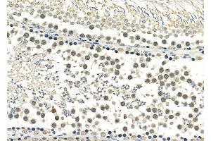 ABIN6259086 and ABIN6275721 at 1/100 staining Rat testis tissue by IHC-P. (Raly anticorps  (Internal Region))