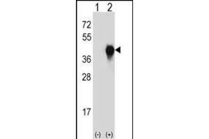 Western blot analysis of PLAUR (arrow) using rabbit polyclonal PLAUR Antibody  (ABIN652429 and ABIN2842227). (PLAUR anticorps  (AA 136-166))