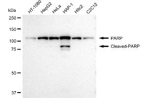 Western blotting analysis using PARP antibody (ABIN7799867).