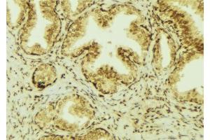 ABIN6277469 at 1/100 staining Mouse colon tissue by IHC-P. (CHI3L1 anticorps  (Internal Region))