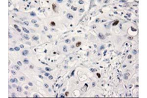 Image no. 6 for anti-Tumor Protein P53 (TP53) antibody (ABIN1499971) (p53 anticorps)