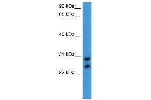 WB Suggested Anti-CEACAM7 Antibody Titration: 0. (CEACAM7 anticorps  (C-Term))