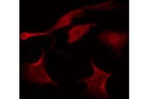 ABIN6278636 staining 293T by IF/ICC.