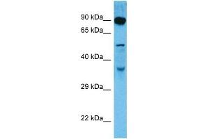 Host:  Rat  Target Name:  DMTF1  Sample Tissue:  Rat Skeletal Muscle  Antibody Dilution:  1ug/ml (DMP1 anticorps  (C-Term))