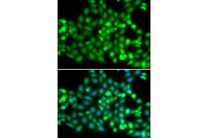 Immunofluorescence analysis of  cells using TRIM69 antibody (ABIN7270998).