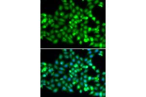 Immunofluorescence analysis of  cells using TRIM69 antibody (ABIN7270998). (TRIM69 anticorps  (AA 1-341))