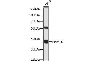 Western blot analysis of extracts of HeLa cells, using PRPF18 antibody (ABIN6132207, ABIN6146254, ABIN6146255 and ABIN6216579) at 1:3000 dilution. (PRPF18 anticorps  (AA 1-342))