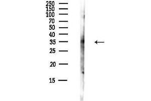 Western blot analysis of lysates from F10-LUC cells(starvation,24h treatment), using RDH8 Antibody at 1/1000 dilution.