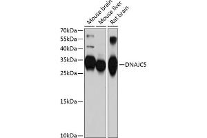 Western blot analysis of extracts of various cell lines, using DN antibody (ABIN6127737, ABIN6139724, ABIN6139725 and ABIN6214762) at 1:1000 dilution. (DNAJC5 anticorps  (AA 1-198))