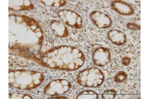 Immunoperoxidase of monoclonal antibody to CES2 on formalin-fixed paraffin-embedded human colon.