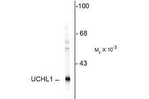 Image no. 1 for anti-Ubiquitin Carboxyl-terminal Esterase L1 (Ubiquitin Thiolesterase) (UCHL1) antibody (ABIN372739)