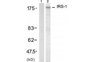 Western blot analysis of extract from 293 cell, using IRS-1 (Ab-312) Antibody (E021166, Lane 1 and 2). (IRS1 anticorps)