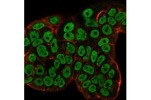 Immunofluorescence staining of MCF-7 cells using Estrogen Receptor alpha Mouse Monoclonal Antibody (ESR1/3557) followed by goat anti-Mouse IgG-CF488 (green).