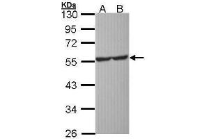 WB Image Sample (30 ug of whole cell lysate) A: Molt-4 , B: Raji 10% SDS PAGE antibody diluted at 1:1000 (Serotonin Receptor 1A anticorps)