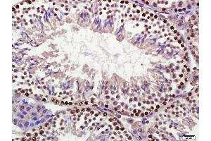 Paraformaldehyde-fixed, paraffin embedded mouse testis, Antigen retrieval by boiling in sodium citrate buffer (pH6) for 15min, Block endogenous peroxidase by 3% hydrogen peroxide for 30 minutes,  Blocking buffer (normal goat serum) at 37°C for 20min, Antibody incubation with DDX4 Polyclonal Antibody (bs-3597R) at 1:400 overnight at 4°C, followed by a conjugated secondary and DAB staining.
