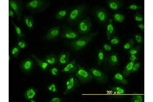 Immunofluorescence of monoclonal antibody to ACD on HeLa cell.