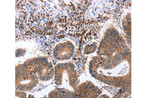 Immunohistochemistry (IHC) image for anti-Ciliary Neurotrophic Factor Receptor (CNTFR) (AA 190-340) antibody (ABIN3016492)