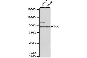 Western blot analysis of extracts of various cell lines, using TAP1 antibody (ABIN1882340) at 1:1000 dilution. (TAP1 anticorps)